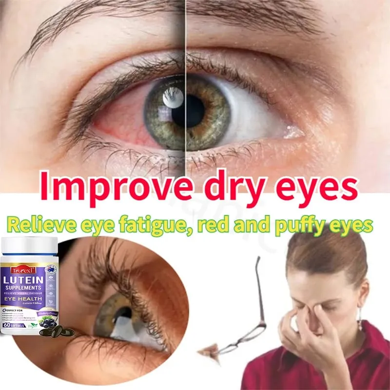Suplemento de extrato de luteína Trorexl Restore Vision para fadiga ocular, alívio da fadiga ocular, olhos vermelhos e secos