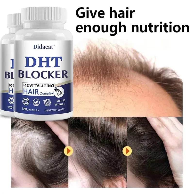 Didacat Advanced DHT Blocker Hair Growth Supplement for Hereditary Thinning Hair - for Men and Women Hair Loss