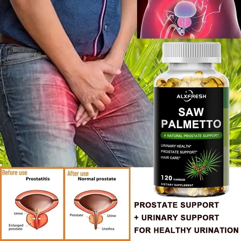 Alxfresh Saw Palmetto apoia a função antioxidante da próstata e a saúde do trato urinário para apoiar o crescimento do cabelo na saúde dos homens